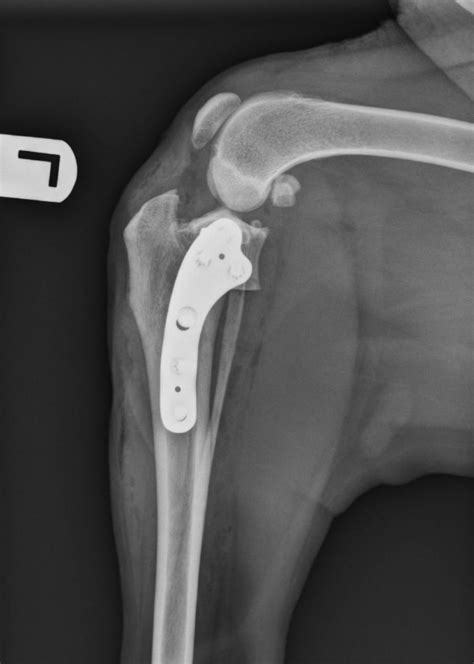 An article in the Journal of the American Veterinary Medical Association November 15, 2005, Vol. . Signs of tplo plate rejection